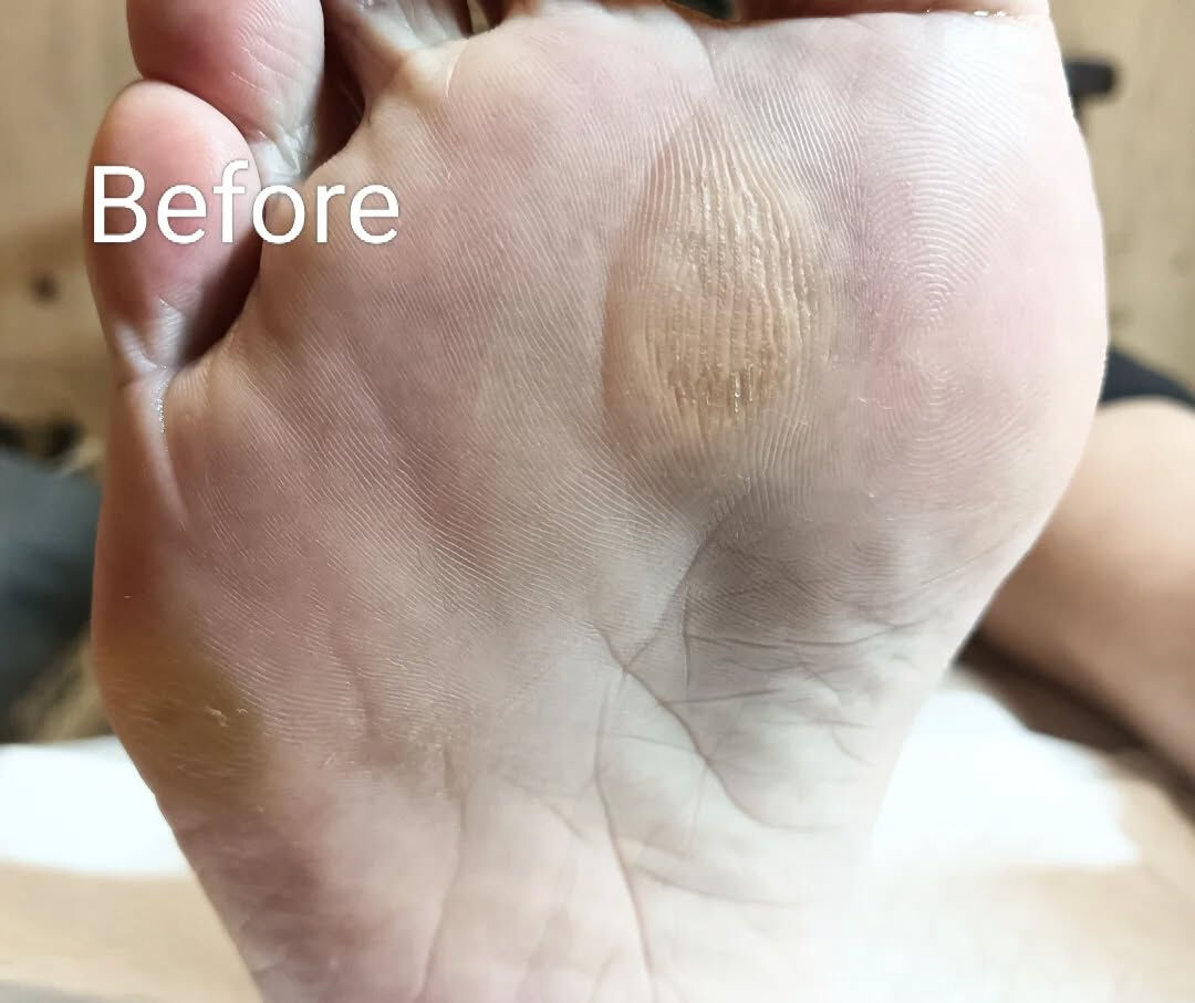 タコケア👣✨