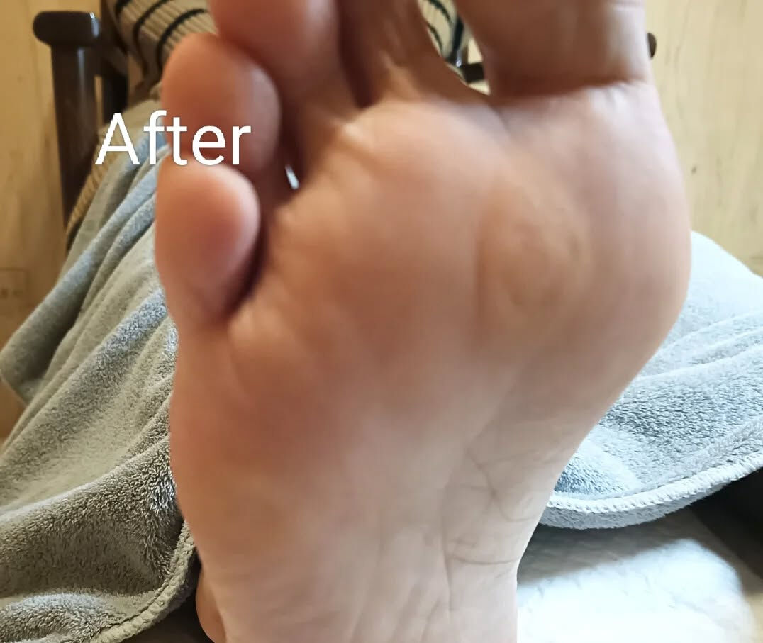 タコケア👣✨