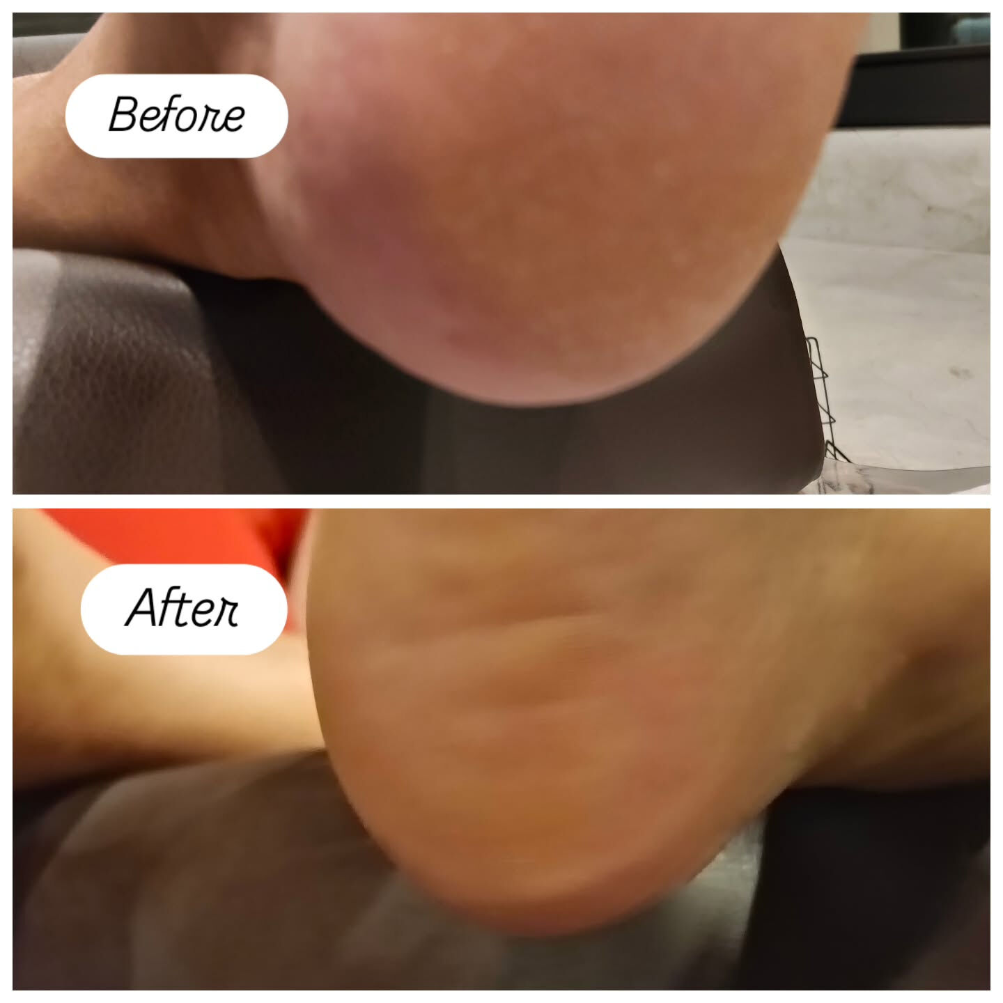 かかと角質ケア👣✨