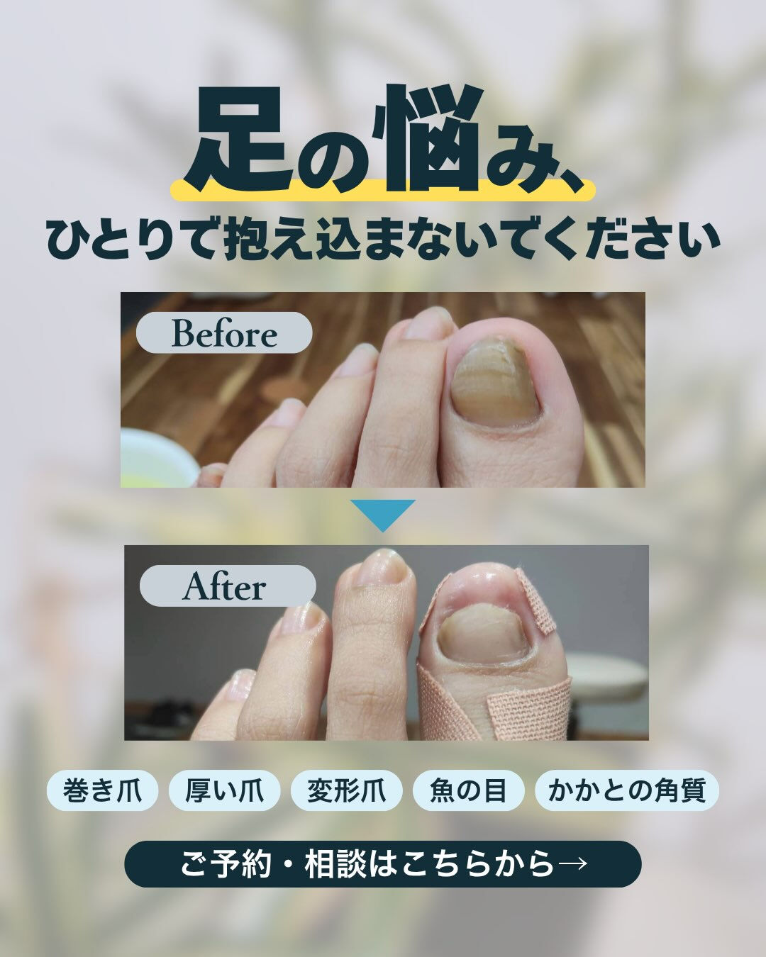 【足や爪のお悩み、ひとりで抱え込んでいませんか？🦶】